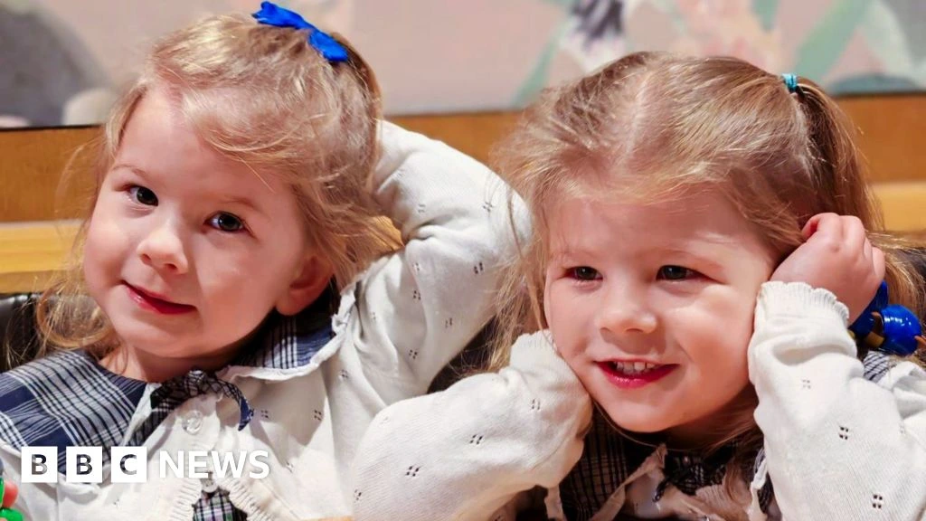 Pioneering treatment saves identical twins from rare pregnancy condition