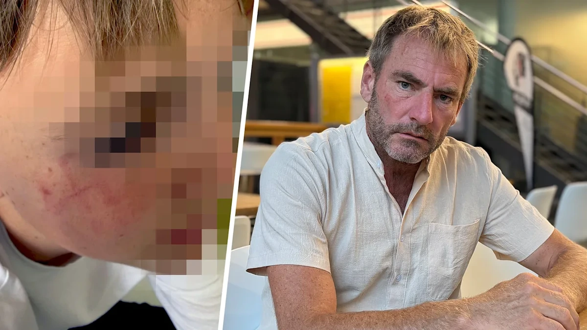 Bahnhof Freiburg: Ein Mann wollte meinem Sohn (14) das Auge ausreißen